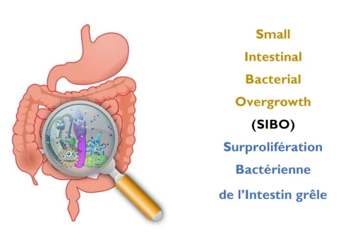 Explication visuelle du SIBO