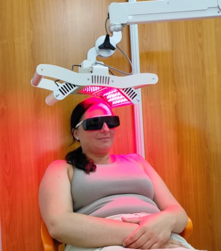 Une photo du traitement laser de la chute des cheveux